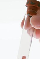 2026兰州大学第一医院试管成功率解读，附试管助孕费用清单